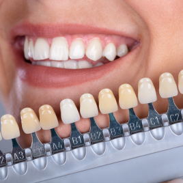 Laser Teeth Whitening (3 Sessions) Gift Voucher
