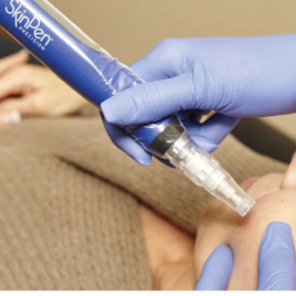 SkinPen 2 Areas Course of 6 Gift Voucher